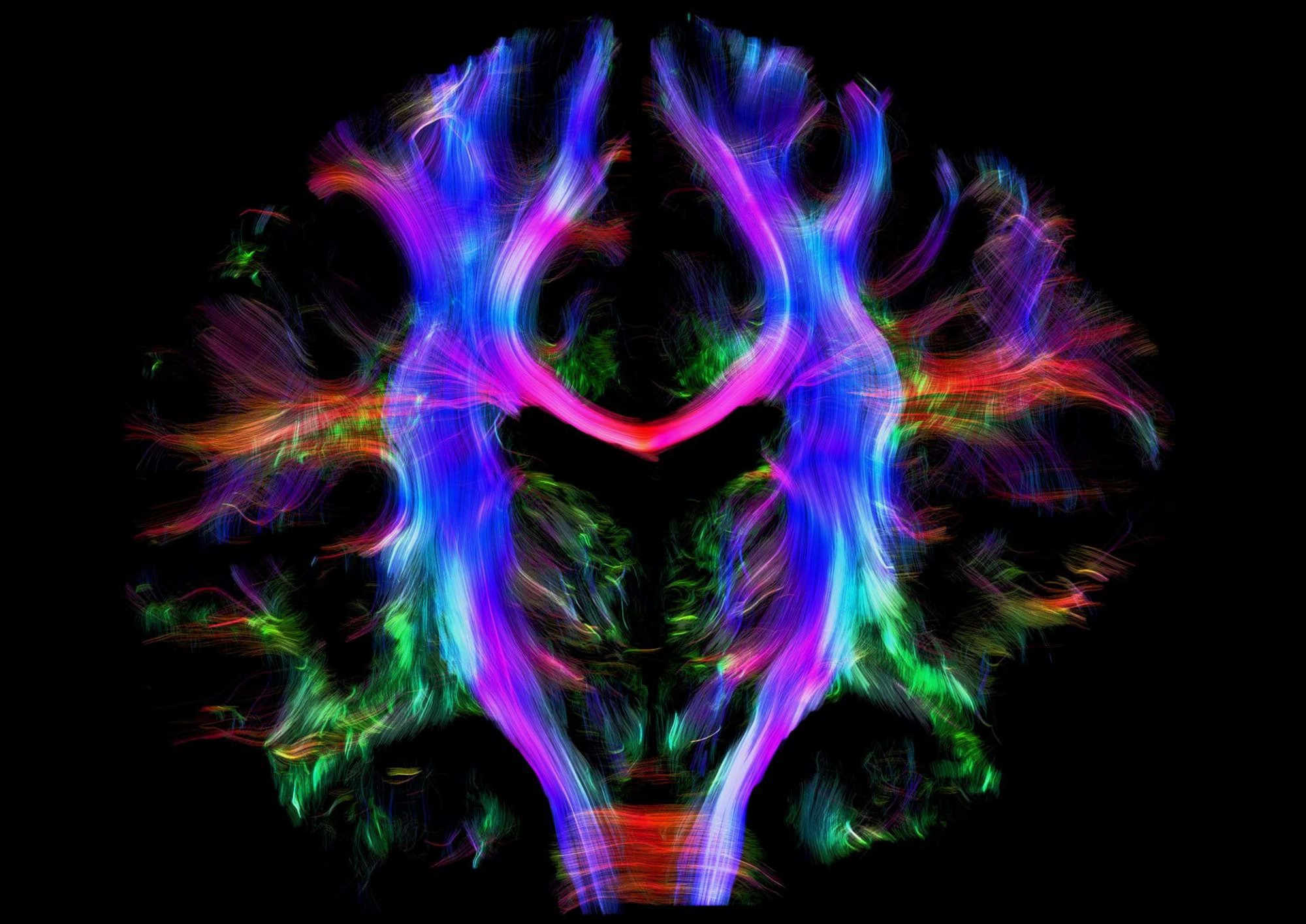 Pathways of nerve fibres – long, slender projections of nerve cells, also known as neurons – connecting in the brain of a young adult. This tractography image was created using a type of magnetic resonance imaging (MRI) at the Max Planck Institute for Human Cognitive and Brain Sciences. © Alfred Awander. CC-BY